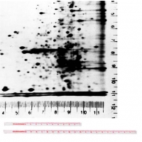 Линейки авторадиографические, набор